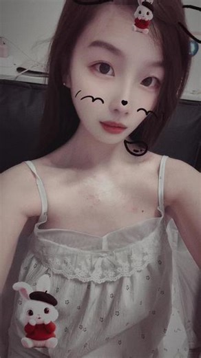#重要通知请大家相互转告 除了上班外……本人在宅家，过敏成都无法想象