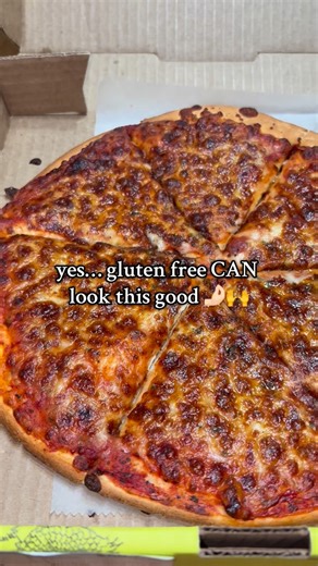 She Craves Gluten Free 😋 on Instagram: "Thank you @pizza_luce for making gluten free so good 🙌😭 Almost any pizza can be made gluten free and they cook GF separately 👏 And let’s talk about those warm gluten-free buns with the spinach artichoke dip… unreal So good every single time 🤤✨ #instareels #glutenfree #celiac #celiacawareness"