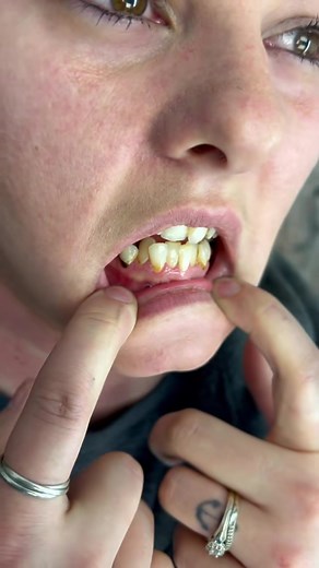 Hey Facebook fam, get ready to be blown away by this insanely amazing video of "I'll meet you halfway 🥹"! Are you ready to experience the love, friendship, and adventure that knows no bounds? This heart-warming video is all you need to watch if you're feeling down or in need of a little inspiration. It's a beautiful reminder that it's never too late to start over, make new memories, and meet someone halfway from where you are to where you want to be. So, click that play button and let your hear