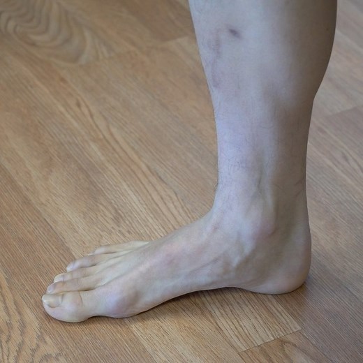 [P]rehab®️ on Instagram: "SHORT FOOT PROGRESSIONS ⁣ ⁣ ☝️This post will demonstrate how to progress the commonly performed short foot. The short foot is accomplished by attempting to bring the base of your big toe towards the heel without curling your toes. You will feel the arch of your foot working as you perform this! ⁣ ⁣ 🙋Who here can perform the last exercise?! ⁣ ⁣ 🦶Shown are 4 exercise progressions to help you master the short foot!⁣ ⁣ 1️⃣Seated Short Foot: This variation allows you to be