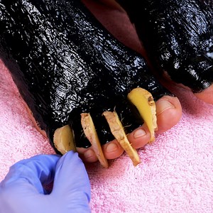 Glow up foot transformation! pedicure that your feet will love🦶 | 5-Minute Crafts Like