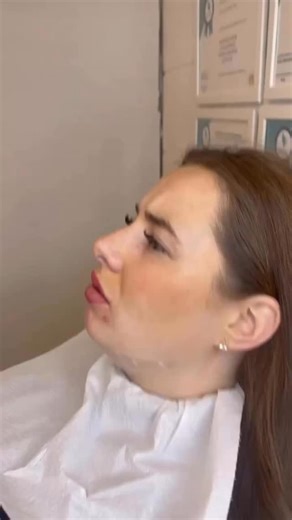 Pure Wellness on Instagram: "Goodbye double chin! 🍋✨ Check out these amazing results from Lemon Bottle fat-dissolving injections. A non-surgical solution for a smoother, more defined jawline. Supervised by Evolve Texas Medical Group #ChinGoals #LemonBottle #FatDissolve #Transformation #PureWellnessAndSpa"