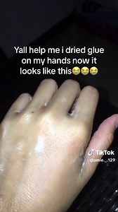 How to Remove Super Glue from Hands: Quick and Easy Solutions