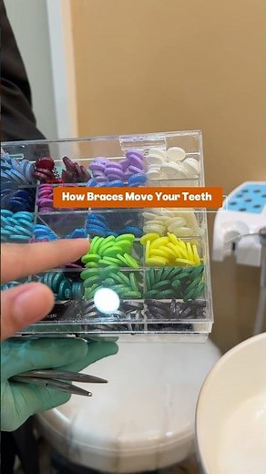 How do braces move your teeth? #bracesquad #orthodontics #bracesexperience