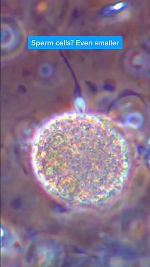 Human Sperm and Egg Under a Microscope #microscope #laboratory #science #‪@irshaddunia‬