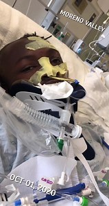 414K views · 2.9K reactions | Fresh’s Story Day 16 in UCI. Condition critical / unaware of any surrounding. Traumatic brain injury survival 10/1/20 4:31pm | Fresh The Dj | Facebook