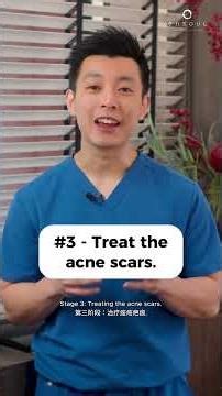 Treating Acne or Acne Scars First? Part 2 | Ensoul Medical Clinic #acnetreatment #acnescars