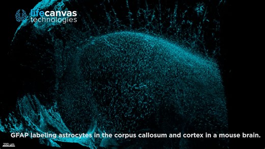 GFAP labeling in mouse brain hippocampus and cortex