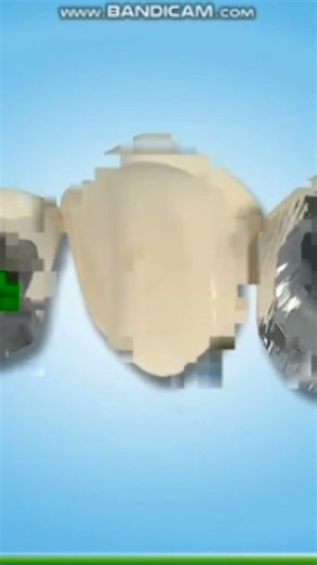 Missing Tooth? See How Crown & Bridge Works