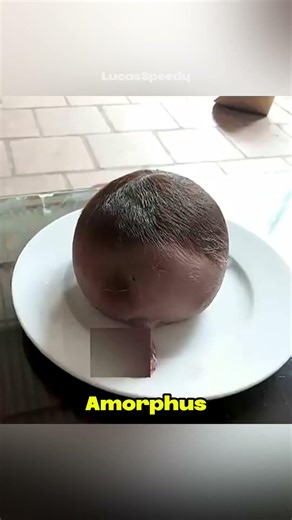 Dieser Zwilling entwickelt keinen Körper! 🤯