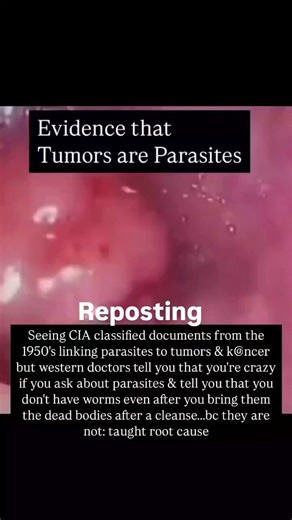REMEMBER when they said Ivermectin was too dangerous for humans?3.7 BILLION doses later, it has one of the safest profiles of any drug ever made.It's actually safer than the aspirin sitting in your medicine cabinet right now.The media KNEW this the entire time.They just never wanted you to find out.Now you know.Share this with someone who still believes the old story.