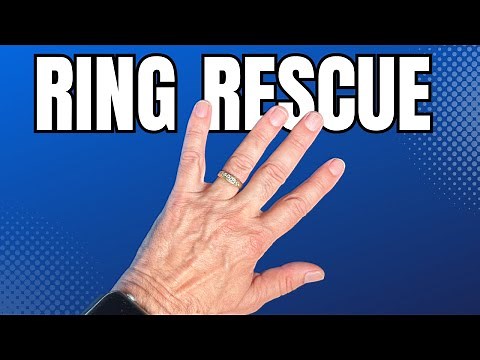How to Safely Remove a Stuck Ring from Your Finger