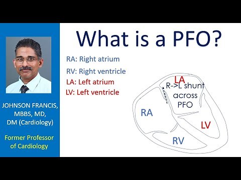 What is a PFO?