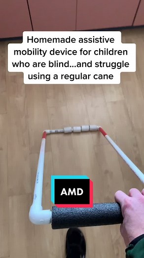 Homemade Assistive Mobility Device for Blind Children