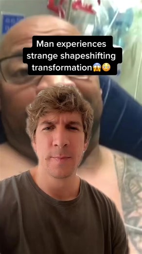 This man says he is experiencing a body shapeshifting mutation #shapeshifter #dna #mutant #fyp #fory | What happns next