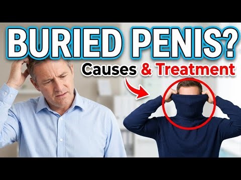 Buried Penis: Why It Happens and How It’s Treated