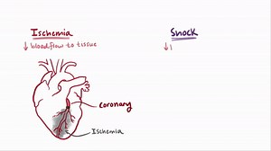 Shock (cardiogenic, hypovolemic, distributive, septic) - causes, symptoms & pathology on Make a GIF