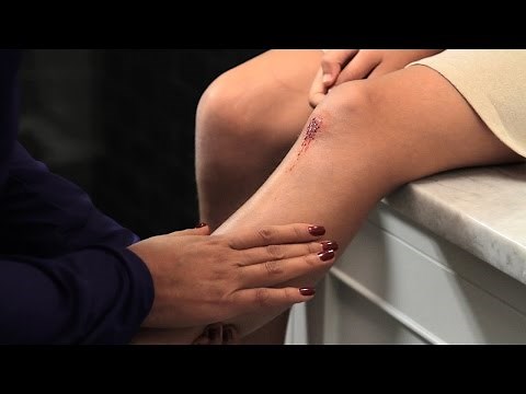 Proper Wound Care: How to Minimize Scarring