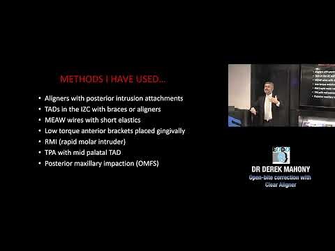 Open-bite correction with Clear Aligner lecture with Dr Derek Mahony