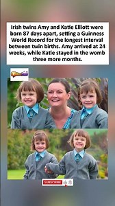 Twins born 87 days apart set world record for the longest gap.