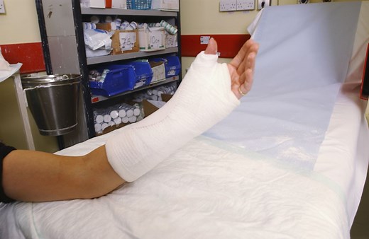 Can You Drive With Only 1 Arm?