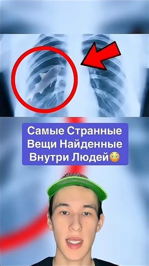 The Strangest Things Found Inside People! 😳 #shorts #doctor #facts #tooth