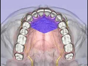 Dr. Malamed local anesthesia maxillary injections