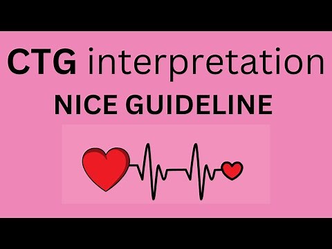 CTG interpretation NICE guideline |aqorn learning | @rahat2021| obgyn | FCPS |