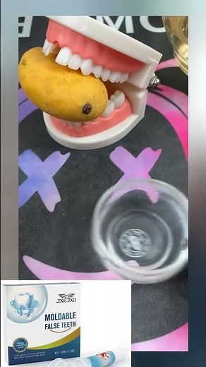 Missingtooth? Mold it in 3s, smile fixed! 😁 DIY at home! #ToothRepairKit #FixYourSmile #DIYDentist