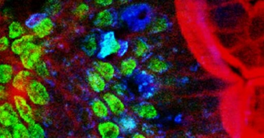 Two-photon excitation microscopy: Why two is better than one