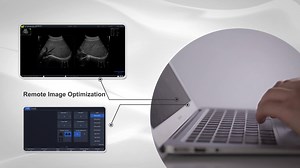 1K views · 24 reactions | VINNO G55 combines high-class performance with compact size to meet all your clinical needs by its unmatched image quality and durability. >>Advanced Technology >>Amazing Simple Workflow >>Scalable TO Different Application >>Easy Connectivity | VINNO Ultrasound | Facebook