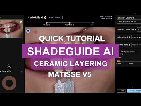 Matisse v5- ShadeGuide AI [Ceramic Layering]
