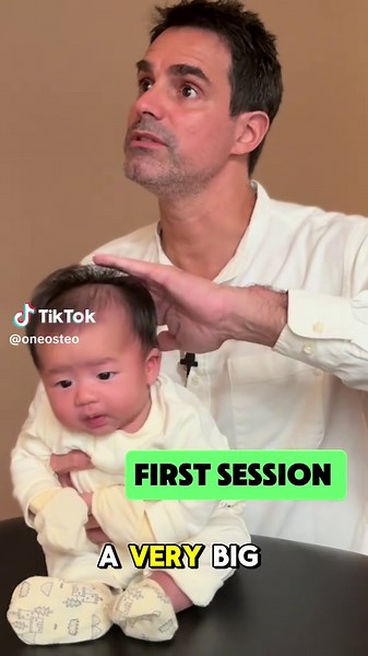 Understanding Flat Head Syndrome and Its Causes