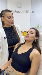 Getting Botox for the first time 👀 #botox #botoxresults #antesydespues #skincare #botoxnatural