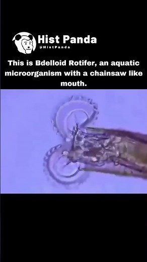 This Microorganism Has a CHAINSAW Mouth?! 😱 | Bdelloid Rotifer