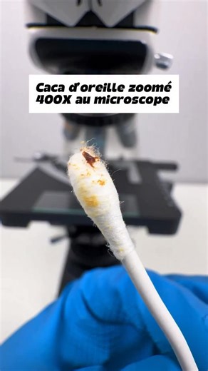 MonsieurMicroscope on Instagram: "Caca d’oreille au microscope ! #microscope #asmr #science #cerumen"