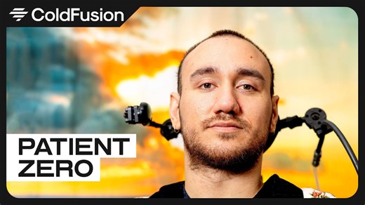 The Race to Control Human Brains Is Escalating