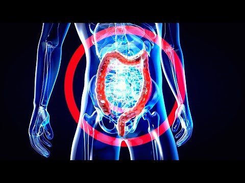 What Foods Promote ‘Good’ Gut Bacteria? - Inside Health