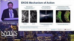 Catheter Directed Thrombolysis: EKOS LYSIS