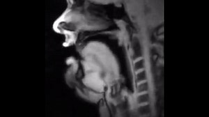 MRI scan shows what happens to body when people talk and sing