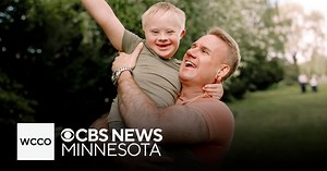 World Down Syndrome Day works to raise awareness, support