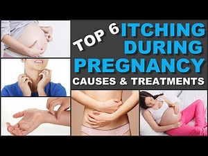 Top 6 Itching During Pregnancy Causes and Treatments