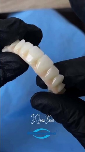 Lumix Monolithic Zirconia Full Arch #dentalzirconia