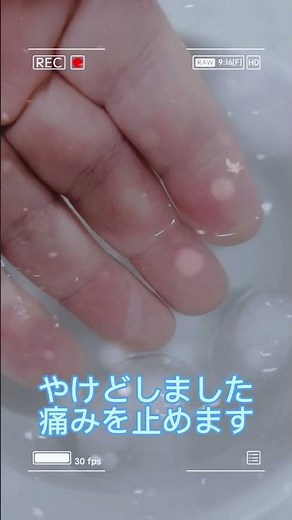 火傷の痛みを和らげる方法#火傷#治療法#ライフハック