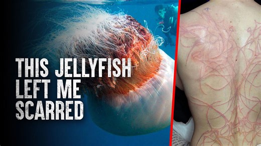 These Deadly Jellyfish Can Kill in Minutes—Here’s How to Survive