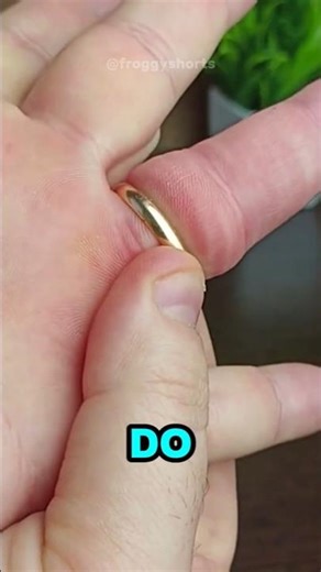 This Is How to Remove a Stuck Ring From Your Finger⁉️💍