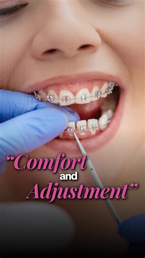 Modern Orthodontics: Comfortable Clear Aligners Explained