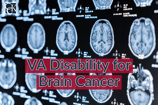 VA Disability for Brain Cancer | CCK Law