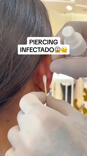 Cómo curar una infección de piercing de manera efectiva