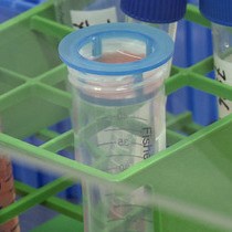 Video: Generation of Induced Pluripotent Stem Cells from Human Melanoma Tumor-infiltrating Lymphocytes